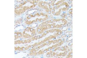 Immunohistochemistry of paraffin-embedded mouse kidney using RPL7 antibody (ABIN6128656, ABIN6147148, ABIN6147149 and ABIN6221631) at dilution of 1:100 (40x lens).