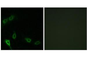 Immunofluorescence analysis of A549 cells, using MARK2 antibody. (MARK2 anticorps  (N-Term))