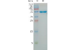 Human L Protein, hFc Tag on SDS-PAGE under reducing condition.