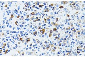Immunohistochemistry of paraffin-embedded Human tonsil using CD63 Polyclonal Antibody at dilution of 1:100 (40x lens). (CD63 anticorps)
