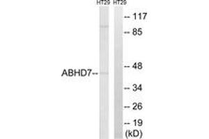 Western blot analysis of extracts from HT-29 cells, using ABHD7 Antibody. (EPHX4 anticorps  (AA 101-150))