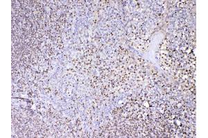 IHC analysis of PAX5 using anti-PAX5 antibody .