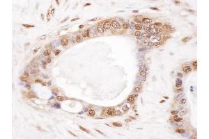 Immunohistochemistry (IHC) image for anti-Proteasome (Prosome, Macropain) Subunit, beta Type 2 (PSMB2) (AA 151-201) antibody (ABIN7453444)