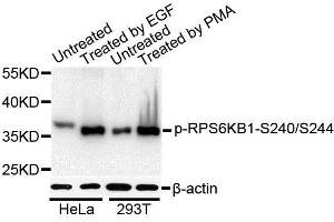 Western blot analysis of extracts of various cell lines, using Phospho-RPS6KB1-S240/244 antibody. (RPS6 anticorps  (pSer240, pSer244))