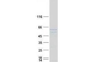 Validation with Western Blot