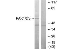 Western blot analysis of extracts from NIH-3T3 cells, using PAK1/2/3 (Ab-423/402/421) Antibody. (PAK1/2/3 anticorps  (AA 391-440))