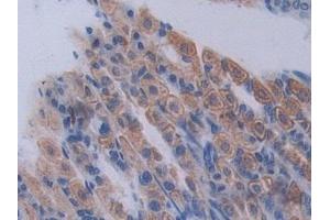 Detection of PCSK1 in Mouse Stomach Tissue using Polyclonal Antibody to Proprotein Convertase Subtilisin/Kexin Type 1 (PCSK1)