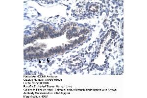 Human Lung (Cyclin H anticorps  (C-Term))