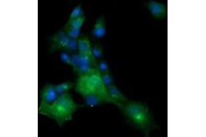 Image no. 2 for anti-Melan A (MLANA) antibody (ABIN1499425) (MLANA anticorps)