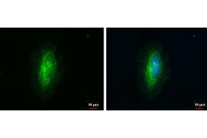 ICC/IF Image ARHGAP1 antibody [N1N3] detects ARHGAP1 protein at cytoplasm by immunofluorescent analysis. (ARHGAP1 anticorps  (N-Term))