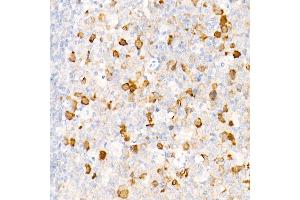 Immunohistochemistry of paraffin-embedded rat lung using cGAS Rabbit pAb (ABIN6134073, ABIN6143590, ABIN6143591 and ABIN6224360) at dilution of 1:50 (40x lens).