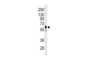 Western blot analysis of anti-PFKFB3 Antibody (C-term) (ABIN392768 and ABIN2842213) in CEM cell line lysates (35 μg/lane).