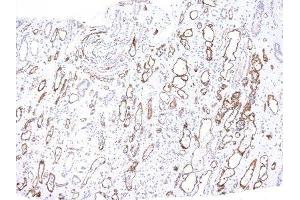 Image no. 2 for anti-Complement Component C4d (C4d) antibody (ABIN6173841) (Complement C4d anticorps)