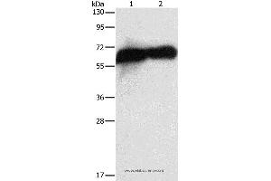 Western blot analysis of HepG2 cell and human placenta tissue, using ALPP Polyclonal Antibody at dilution of 1:1450 (PLAP anticorps)