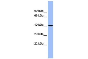 CEACAM6 antibody used at 1 ug/ml to detect target protein.