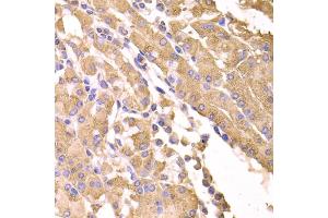 Immunohistochemistry of paraffin-embedded human stomach using SUFU antibody (ABIN5974087) at dilution of 1/100 (40x lens). (SUFUH anticorps)