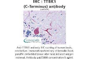 Image no. 1 for anti-tau Tubulin Kinase 1 (Ttbk1) (C-Term) antibody (ABIN1740433) (TTBK1 anticorps  (C-Term))