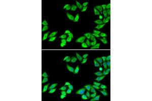 Immunofluorescence analysis of MCF7 cells using RPS14 antibody.