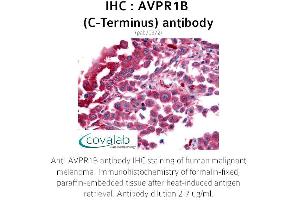 Image no. 1 for anti-Arginine Vasopressin Receptor 1B (AVPR1B) (C-Term) antibody (ABIN1732149) (AVPR1B anticorps  (C-Term))