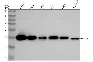Western blot analysis of PRDX2 using anti-PRDX2 antibody (ABIN7605914).