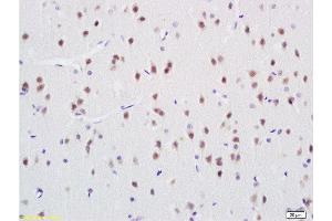 Formalin-fixed and paraffin embedded rat brain labeled with Rabbit Anti ANP32C Polyclonal Antibody, Unconjugated  at 1:200 followed by conjugation to the secondary antibody and DAB staining