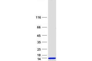 Validation with Western Blot