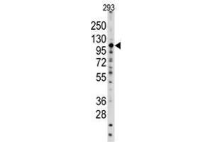Image no. 1 for anti-Sal-Like 4 (SALL4) (C-Term) antibody (ABIN357018) (SALL4 anticorps  (C-Term))