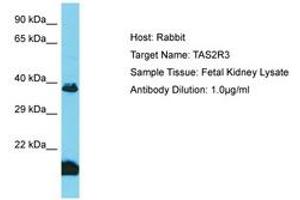 Image no. 1 for anti-Taste Receptor, Type 2, Member 3 (TAS2R3) (AA 129-178) antibody (ABIN6750602) (TAS2R3 anticorps  (AA 129-178))