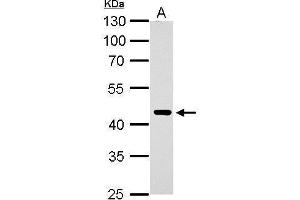 WB Image ERCC8 antibody detects ERCC8 protein by Western blot analysis.