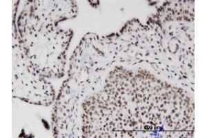Image no. 1 for anti-RIO Kinase 2 (RIOK2) (AA 453-552) antibody (ABIN599575) (RIOK2 anticorps  (AA 453-552))