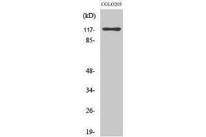 Western Blotting (WB) image for anti-DNA-Damage-Inducible Transcript 3 (DDIT3) (N-Term) antibody (ABIN3183583) (DDIT3 anticorps  (N-Term))