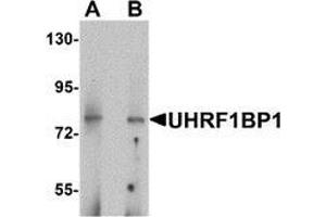 Western blot analysis of UHRF1BP1 in mouse kidney tissue lysate with UHRF1BP1 antibody at (A) 1 and (B) 2 μg/mL (UHRF1BP1 anticorps  (Middle Region))