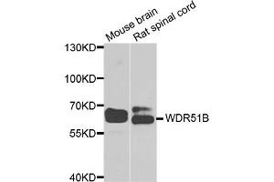 Western blot analysis of extracts of various cell lines, using POC1B antibody (ABIN5974757) at 1/1000 dilution. (POC1B anticorps)
