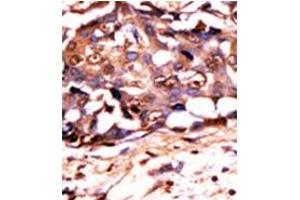Image no. 1 for anti-Signal Transducer and Activator of Transcription 3 (Acute-Phase Response Factor) (STAT3) (pTyr705) antibody (ABIN358234) (STAT3 anticorps  (pTyr705))