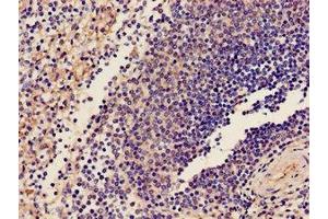 Immunohistochemistry of paraffin-embedded human spleen tissue using ABIN7163589 at dilution of 1:100 (CD42a anticorps  (AA 17-88))