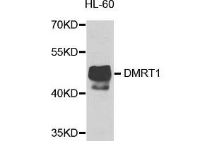 Western blot analysis of extracts of HL-60 cells, using DMRT1 antibody. (DMRT1 anticorps)