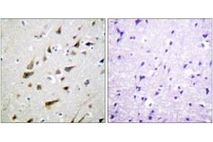 Immunohistochemistry analysis of paraffin-embedded human brain tissue, using Calsenilin/KCNIP3 (Ab-63) Antibody. (DREAM anticorps  (AA 29-78))