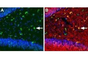 Expression of KCNQ5 in rat hippocampus - Immunohistochemical staining of immersion-fixed, free floating rat brain frozen sections using Anti-KCNQ5 Antibody (ABIN7043507, ABIN7045050 and ABIN7045051), (1:100). (KCNQ5 anticorps  (C-Term, Intracellular))