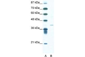 WB Suggested Anti-HIF1AN Antibody Titration:  1.