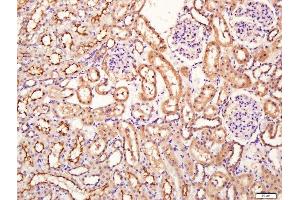Paraformaldehyde-fixed, paraffin embedded rat kidney tissue, Antigen retrieval by boiling in sodium citrate buffer(pH6) for 15min, Block endogenous peroxidase by 3% hydrogen peroxide for 30 minutes, Blocking buffer (normal goat serum) at 37°C for 20min, Antibody incubation with Rabbit Anti-SIRT4 Polyclonal Antibody, Unconjugated  at 1:400 overnight at 4°C, followed by a conjugated secondary and DAB staining