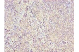 Immunohistochemistry of paraffin-embedded human tonsil tissue using ABIN7157054 at dilution of 1:100 (ISCA2 anticorps  (AA 9-154))