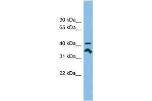 WB Suggested Anti-RRAGC Antibody Titration: 0. (GTR2 anticorps  (N-Term))