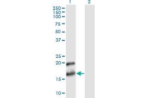 Western Blot analysis of PTN expression in transfected 293T cell line by PTN monoclonal antibody (M02), clone 2E3. (Pleiotrophin anticorps  (AA 45-154))