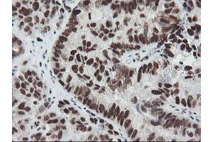 Image no. 13 for anti-TP53RK Binding Protein (TPRKB) antibody (ABIN1501484)