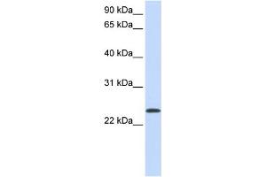 ARF1 antibody - middle region  validated by WB using Fetal lung Lysate at 0. (ARF1 anticorps  (Middle Region))