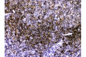 CD40/TNFRSF5 was detected in paraffin-embedded sections of mouse lymphaden tissues using rabbit anti- CD40/TNFRSF5 Antigen Affinity purified polyclonal antibody (Catalog # ) at 1 ?