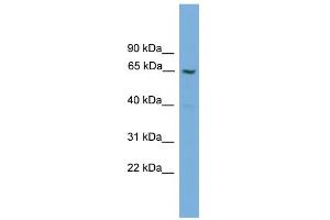 WB Suggested Anti-GGT2 Antibody Titration:  0. (gGT2 anticorps  (N-Term))
