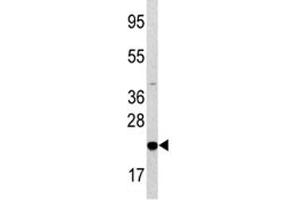 Western blot analysis of Bad antibody and HL-60 lysate. (BAD anticorps  (AA 53-81))