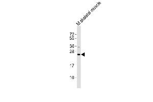 All lanes : Anti-Ctf1 Antibody at 1:2000 dilution + mouse skeletal muscle lysates Lysates/proteins at 20 μg per lane.