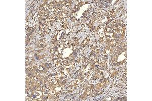 IHC analysis of TST using anti-TST antibody (ABIN7599105). (TST anticorps  (AA 1-220))